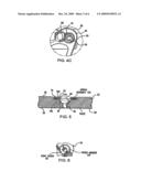 BONE SCREW REMOVAL SYSTEM diagram and image