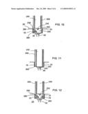 BONE SCREW REMOVAL SYSTEM diagram and image