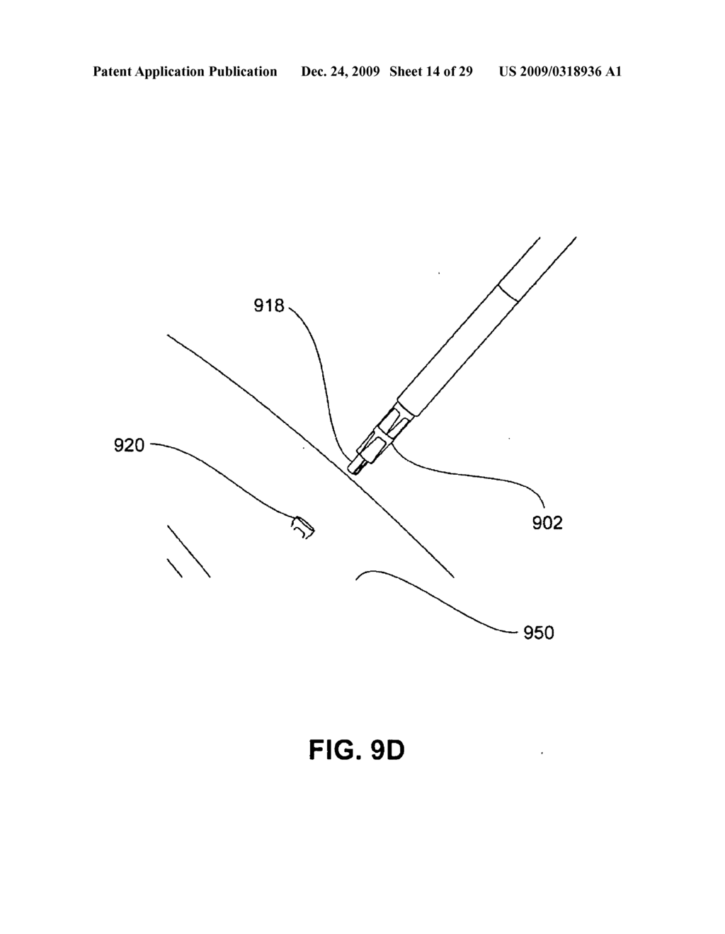 METHODS, DEVICES AND SYSTEMS FOR APPROXIMATION AND FASTENING OF SOFT TISSUE - diagram, schematic, and image 15