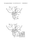 FIBROID TREATMENT APPARATUS AND METHOD diagram and image