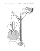 FIBROID TREATMENT APPARATUS AND METHOD diagram and image