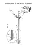 FIBROID TREATMENT APPARATUS AND METHOD diagram and image