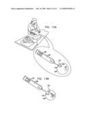 FIBROID TREATMENT APPARATUS AND METHOD diagram and image