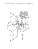 FIBROID TREATMENT APPARATUS AND METHOD diagram and image