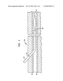 DEVICE AND METHOD FOR COMPRESSING WOUNDS diagram and image