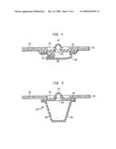 DEVICE AND METHOD FOR COMPRESSING WOUNDS diagram and image