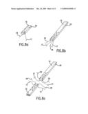 METHOD OF SUTURING diagram and image