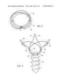 Method and Apparatus for Coupling Soft Tissue to a Bone diagram and image