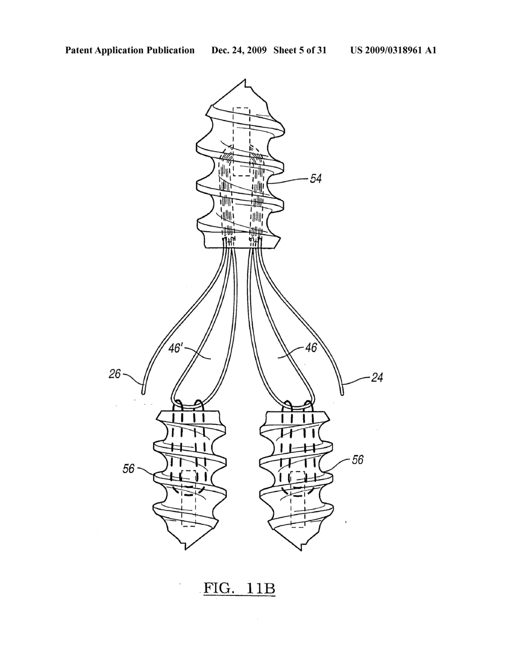 Method and Apparatus for Coupling Soft Tissue to a Bone - diagram, schematic, and image 06