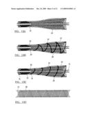 Method and Apparatus for Coupling Soft Tissue to a Bone diagram and image