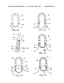 Method and Apparatus for Coupling Soft Tissue to a Bone diagram and image