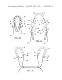 Method and Apparatus for Coupling Soft Tissue to a Bone diagram and image