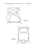 Method and Apparatus for Coupling Soft Tissue to a Bone diagram and image