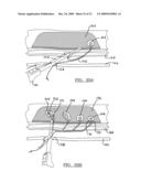 Method and Apparatus for Coupling Soft Tissue to a Bone diagram and image