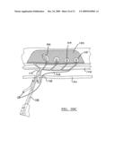 Method and Apparatus for Coupling Soft Tissue to a Bone diagram and image