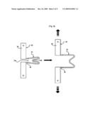 Spacer for use in a surgical operation for spinous process of spine diagram and image