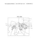 Rod Reducer Method diagram and image