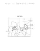 Rod Reducer Method diagram and image