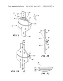 IMPLANTABLE BRACE FOR PROVIDING JOINT SUPPORT diagram and image