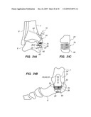 IMPLANTABLE BRACE FOR PROVIDING JOINT SUPPORT diagram and image