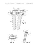 IMPLANTABLE ORTHOPAEDIC DEVICE, IN PARTICULAR FOR THE CERVICAL SPINE diagram and image