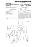 TRANSVASCULAR BALLOON CATHETER WITH PACING ELECTRODES ON SHAFT diagram and image