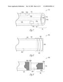 TRANSVASCULAR BALLOON CATHETER WITH PACING ELECTRODES ON SHAFT diagram and image