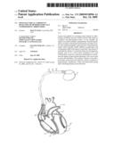 OPTO-ELECTRICAL COHERENCE DETECTION OF HEMODYNAMICALLY COMPROMISING ARRHYTHMIA diagram and image