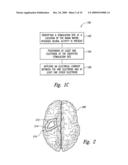 METHODS AND APPARATUS FOR EFFECTUATING A CHANGE IN A NEURAL-FUNCTION OF A PATIENT diagram and image