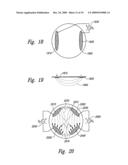 METHODS AND APPARATUS FOR EFFECTUATING A CHANGE IN A NEURAL-FUNCTION OF A PATIENT diagram and image