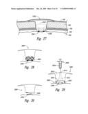 METHODS AND APPARATUS FOR EFFECTUATING A CHANGE IN A NEURAL-FUNCTION OF A PATIENT diagram and image