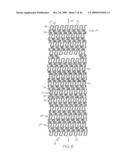 Stent with Protruding Branch Portion for Bifurcated Vessels diagram and image