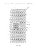 Stent with Protruding Branch Portion for Bifurcated Vessels diagram and image