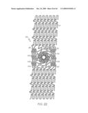 Stent with Protruding Branch Portion for Bifurcated Vessels diagram and image