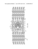 Stent with Protruding Branch Portion for Bifurcated Vessels diagram and image