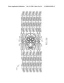 Stent with Protruding Branch Portion for Bifurcated Vessels diagram and image