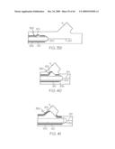 Stent with Protruding Branch Portion for Bifurcated Vessels diagram and image