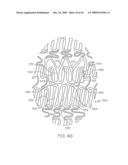 Stent with Protruding Branch Portion for Bifurcated Vessels diagram and image