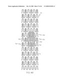 Stent with Protruding Branch Portion for Bifurcated Vessels diagram and image