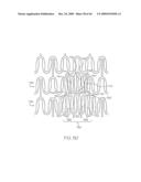 Stent with Protruding Branch Portion for Bifurcated Vessels diagram and image