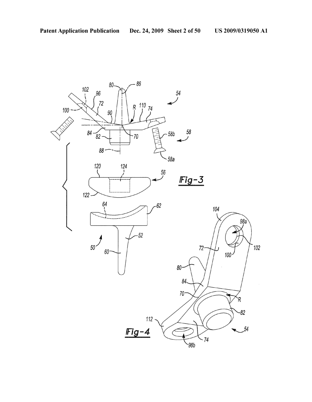 Method and Apparatus for Wrist Arthroplasty - diagram, schematic, and image 03