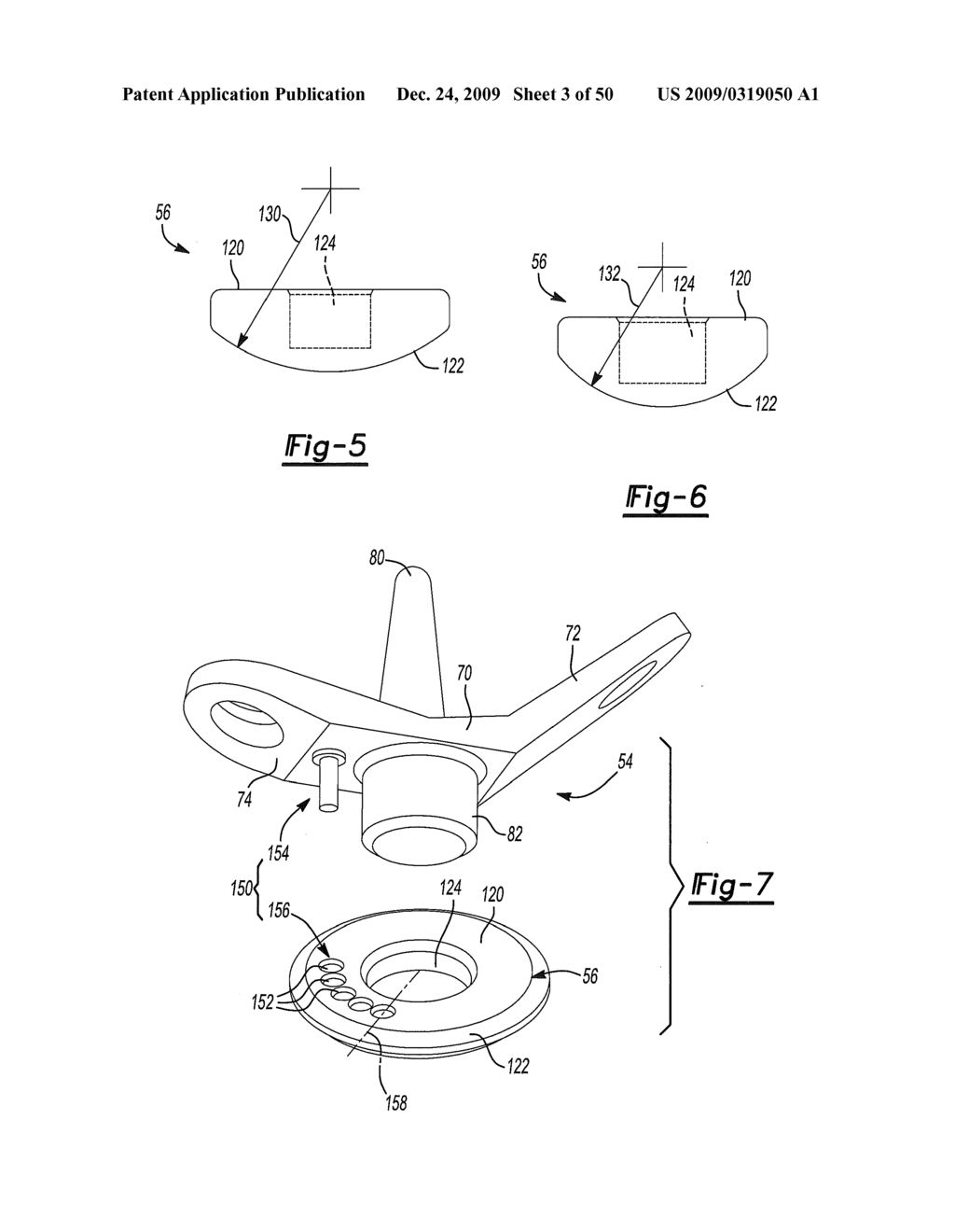 Method and Apparatus for Wrist Arthroplasty - diagram, schematic, and image 04