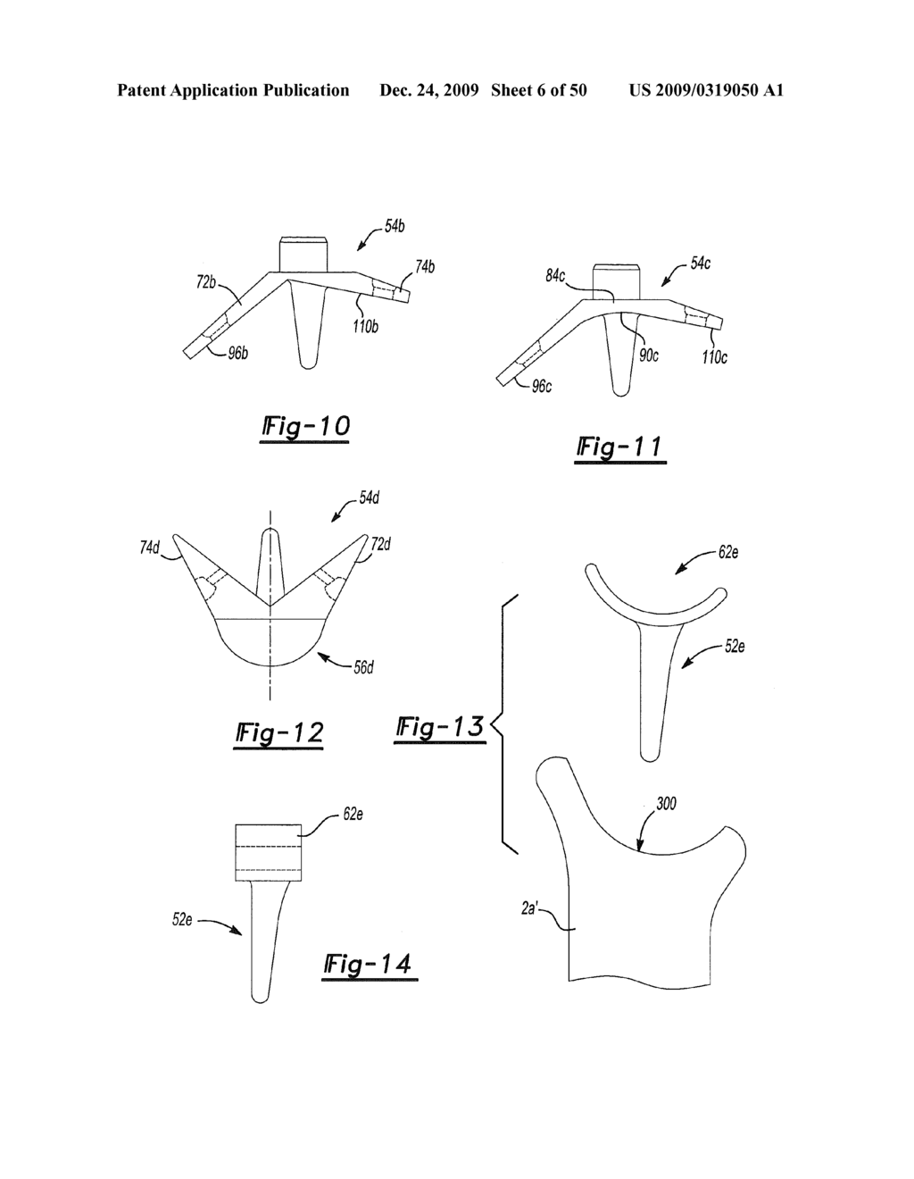 Method and Apparatus for Wrist Arthroplasty - diagram, schematic, and image 07