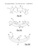 Method and Apparatus for Wrist Arthroplasty diagram and image