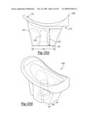 Method and Apparatus for Wrist Arthroplasty diagram and image