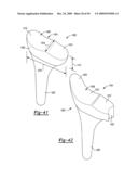 Method and Apparatus for Wrist Arthroplasty diagram and image