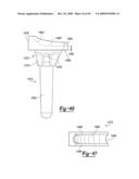 Method and Apparatus for Wrist Arthroplasty diagram and image