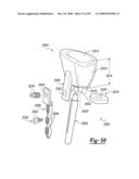 Method and Apparatus for Wrist Arthroplasty diagram and image