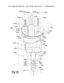 Method and Apparatus for Wrist Arthroplasty diagram and image