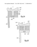 Method and Apparatus for Wrist Arthroplasty diagram and image